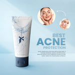 Acne Face wash - cream x emirates